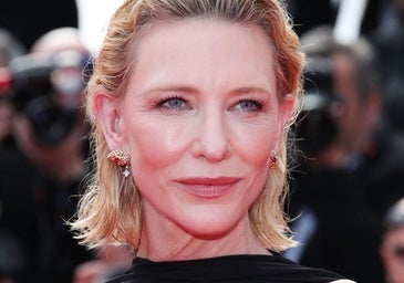 Efecto lifting sin cirugía: cómo levantar el rostro con estos tratamientos